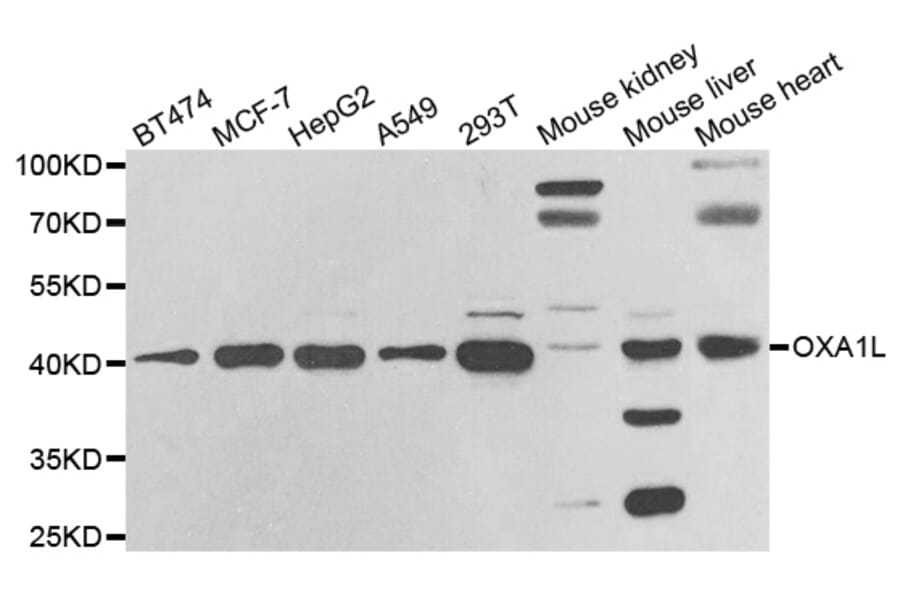 Western blot - OXA1L antibody from Signalway Antibody (38806) - Antibodies.com