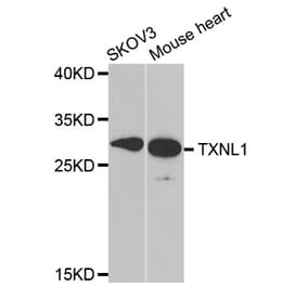 Western blot - TXNL1 antibody from Signalway Antibody (38824) - Antibodies.com