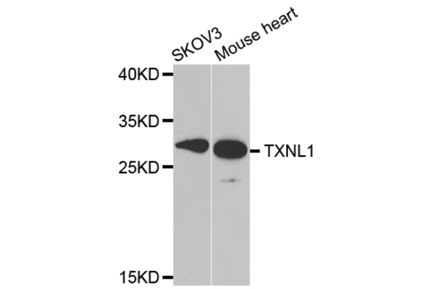 Western blot - TXNL1 antibody from Signalway Antibody (38824) - Antibodies.com