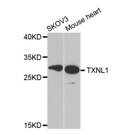 Western blot - TXNL1 antibody from Signalway Antibody (38824) - Antibodies.com