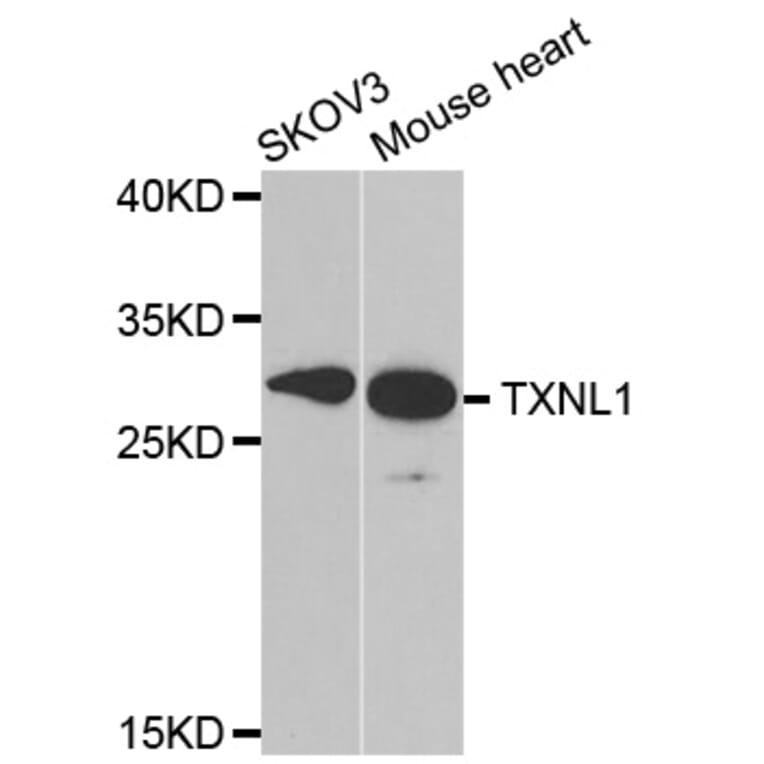 Western blot - TXNL1 antibody from Signalway Antibody (38824) - Antibodies.com