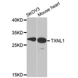 Western blot - TXNL1 antibody from Signalway Antibody (38824) - Antibodies.com