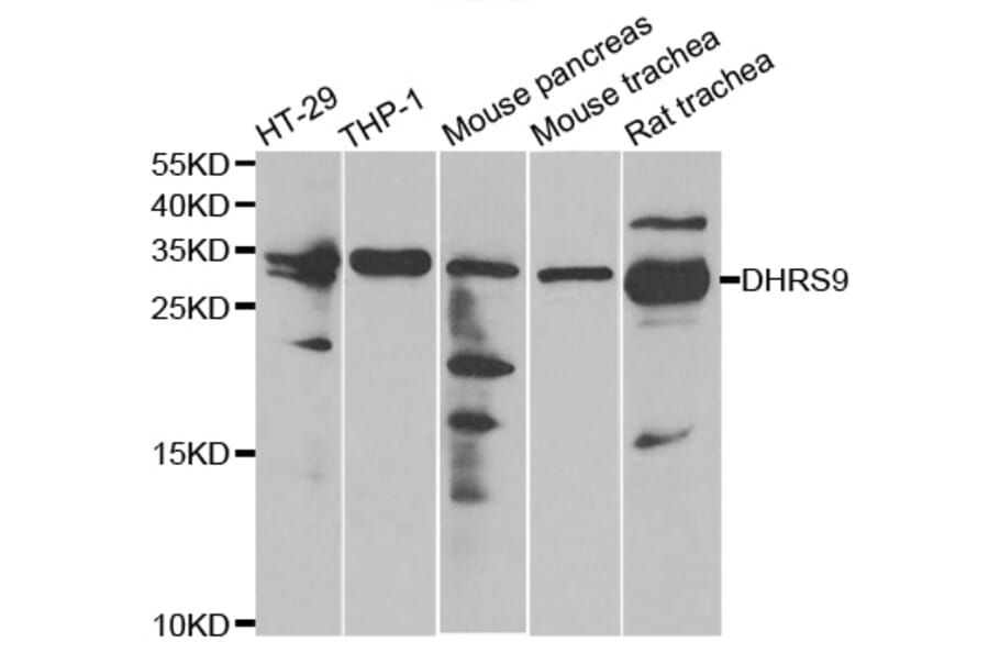 Western blot - DHRS9 antibody from Signalway Antibody (38825) - Antibodies.com