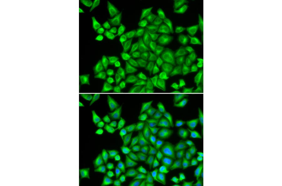 Immunofluorescence - DHRS9 antibody from Signalway Antibody (38825) - Antibodies.com