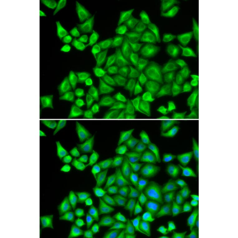 Immunofluorescence - DHRS9 antibody from Signalway Antibody (38825) - Antibodies.com