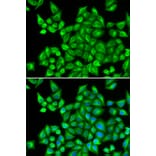 Immunofluorescence - DHRS9 antibody from Signalway Antibody (38825) - Antibodies.com