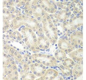 Immunohistochemistry - PRDX5 antibody from Signalway Antibody (38828) - Antibodies.com