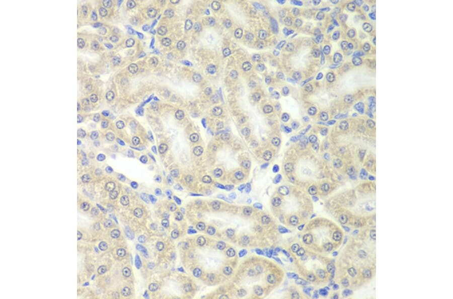 Immunohistochemistry - PRDX5 antibody from Signalway Antibody (38828) - Antibodies.com