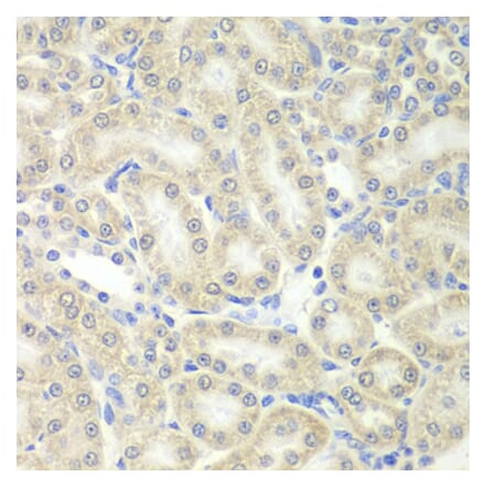 Immunohistochemistry - PRDX5 antibody from Signalway Antibody (38828) - Antibodies.com