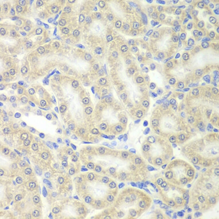 Immunohistochemistry - PRDX5 antibody from Signalway Antibody (38828) - Antibodies.com
