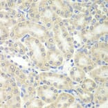 Immunohistochemistry - PRDX5 antibody from Signalway Antibody (38828) - Antibodies.com