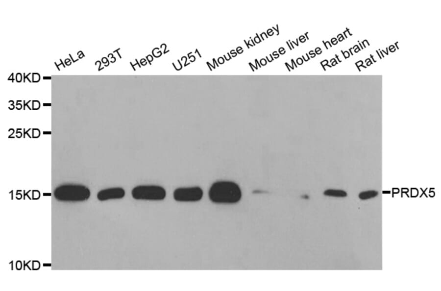 Western blot - PRDX5 antibody from Signalway Antibody (38828) - Antibodies.com