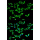Immunofluorescence - PRDX5 antibody from Signalway Antibody (38828) - Antibodies.com