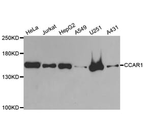 Western blot - CCAR1 antibody from Signalway Antibody (38833) - Antibodies.com