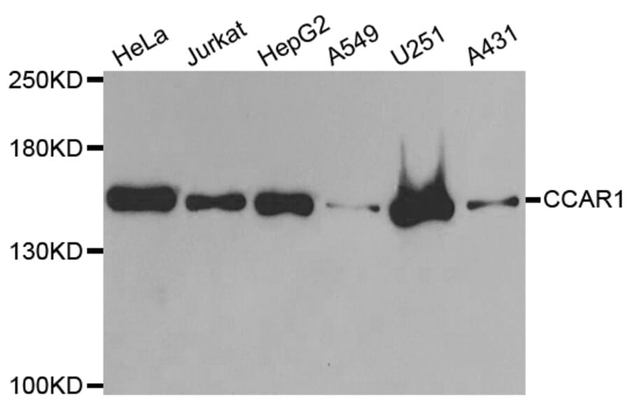 Western blot - CCAR1 antibody from Signalway Antibody (38833) - Antibodies.com