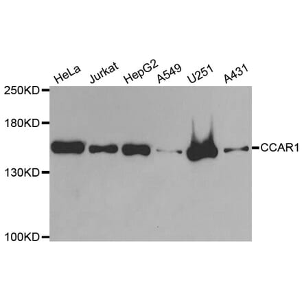 Western blot - CCAR1 antibody from Signalway Antibody (38833) - Antibodies.com