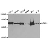 Western blot - CCAR1 antibody from Signalway Antibody (38833) - Antibodies.com