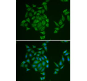 Immunofluorescence - AMPD3 antibody from Signalway Antibody (38841) - Antibodies.com