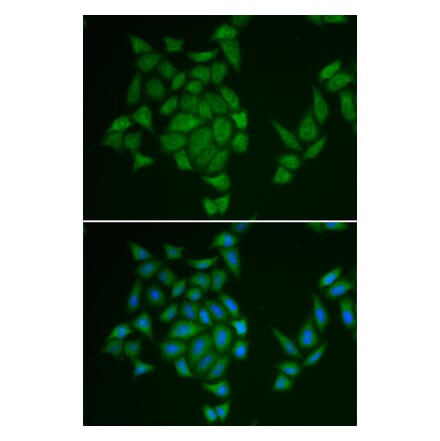 Immunofluorescence - AMPD3 antibody from Signalway Antibody (38841) - Antibodies.com