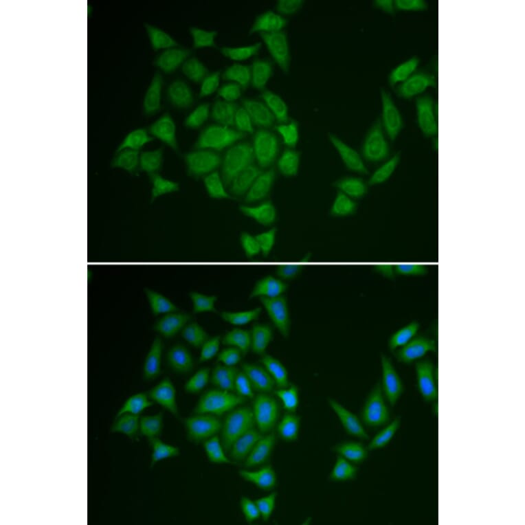 Immunofluorescence - AMPD3 antibody from Signalway Antibody (38841) - Antibodies.com