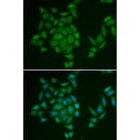 Immunofluorescence - AMPD3 antibody from Signalway Antibody (38841) - Antibodies.com