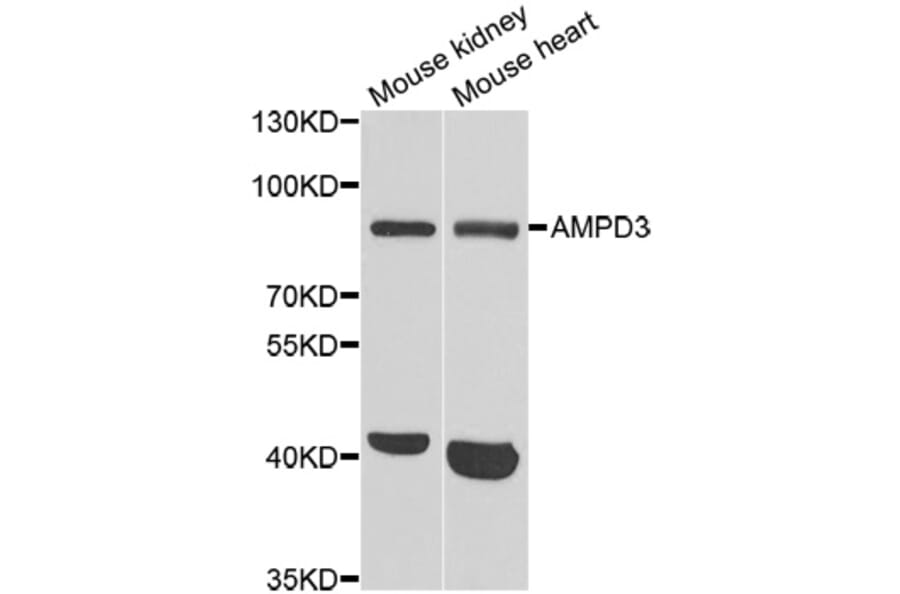 Western blot - AMPD3 antibody from Signalway Antibody (38841) - Antibodies.com