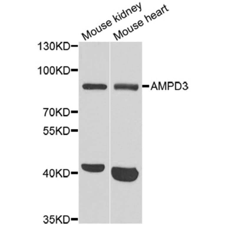 Western blot - AMPD3 antibody from Signalway Antibody (38841) - Antibodies.com