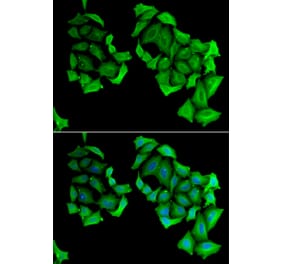 Immunofluorescence - C4BPB antibody from Signalway Antibody (38847) - Antibodies.com