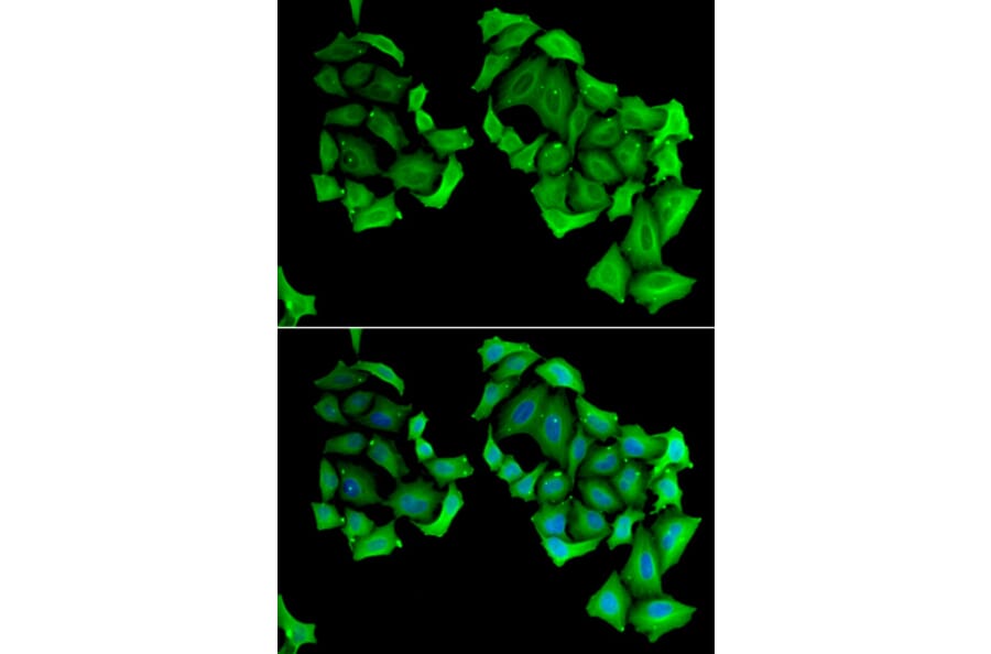 Immunofluorescence - C4BPB antibody from Signalway Antibody (38847) - Antibodies.com