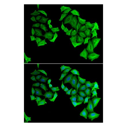 Immunofluorescence - C4BPB antibody from Signalway Antibody (38847) - Antibodies.com