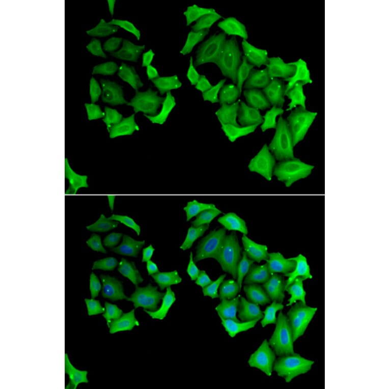 Immunofluorescence - C4BPB antibody from Signalway Antibody (38847) - Antibodies.com