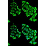 Immunofluorescence - C4BPB antibody from Signalway Antibody (38847) - Antibodies.com