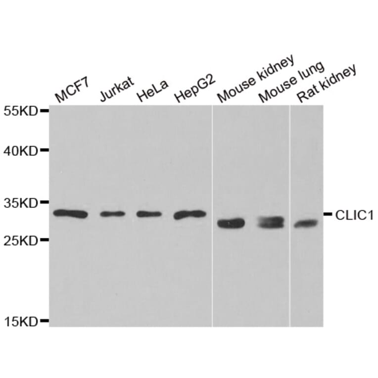 Western blot - CLIC1 antibody from Signalway Antibody (38848) - Antibodies.com