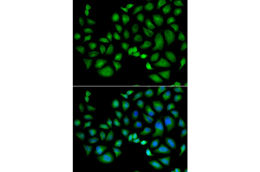 Immunofluorescence - CLIC1 antibody from Signalway Antibody (38848) - Antibodies.com