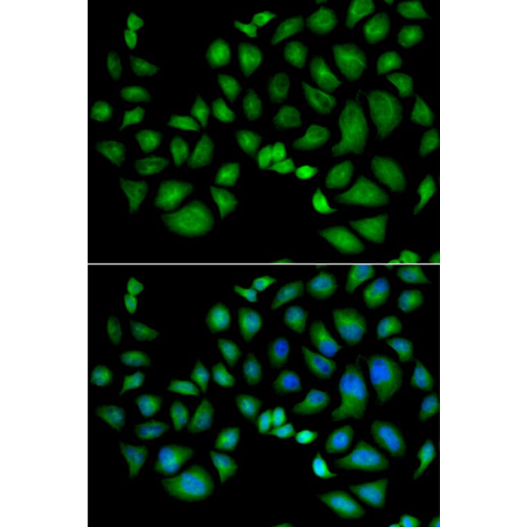 Immunofluorescence - CLIC1 antibody from Signalway Antibody (38848) - Antibodies.com