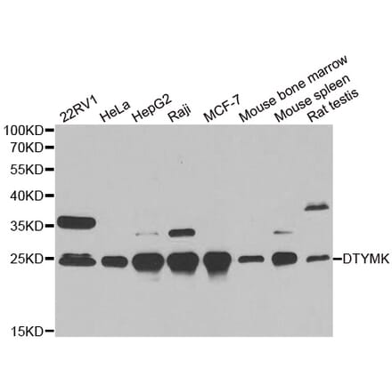 Western blot - DTYMK antibody from Signalway Antibody (38855) - Antibodies.com