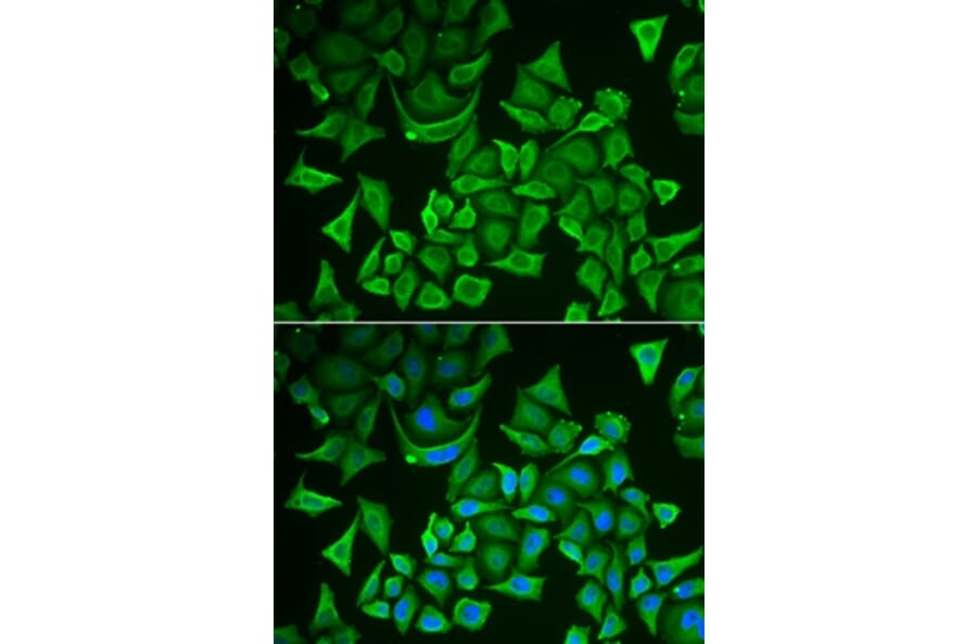 Immunofluorescence - DTYMK antibody from Signalway Antibody (38855) - Antibodies.com
