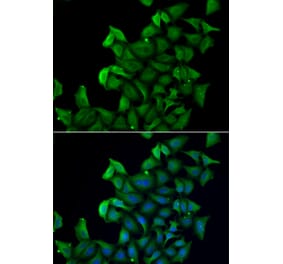 Immunofluorescence - FABP5 antibody from Signalway Antibody (38858) - Antibodies.com
