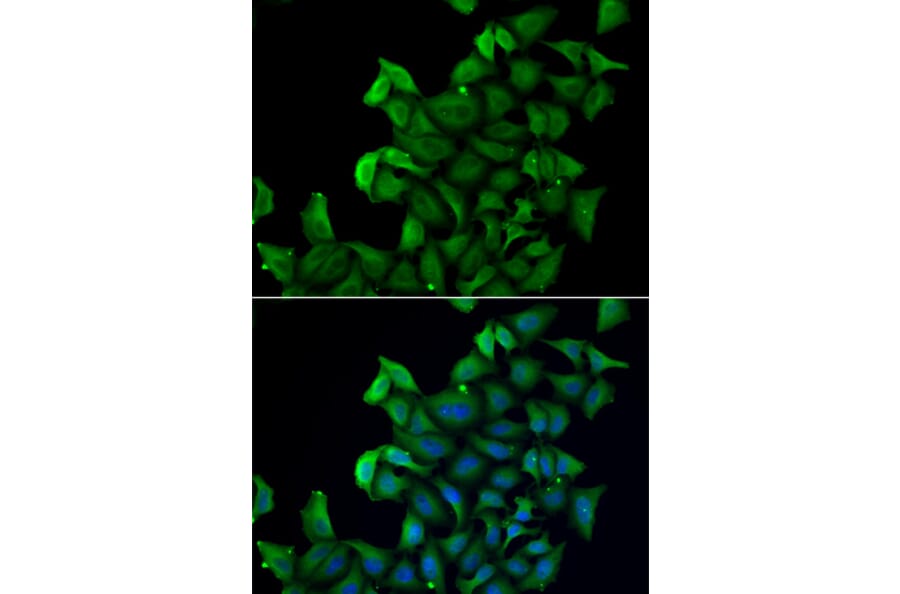 Immunofluorescence - FABP5 antibody from Signalway Antibody (38858) - Antibodies.com