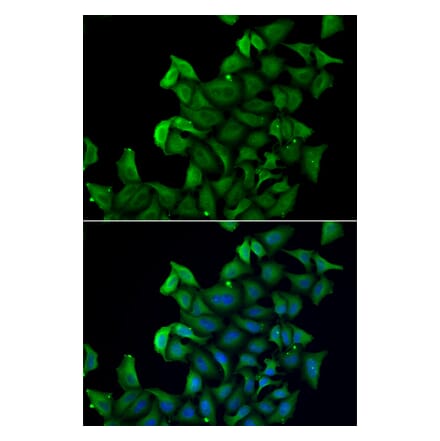 Immunofluorescence - FABP5 antibody from Signalway Antibody (38858) - Antibodies.com