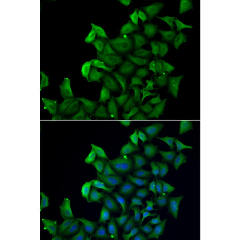 Immunofluorescence - FABP5 antibody from Signalway Antibody (38858) - Antibodies.com