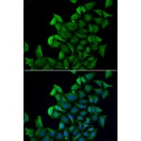 Immunofluorescence - FABP5 antibody from Signalway Antibody (38858) - Antibodies.com