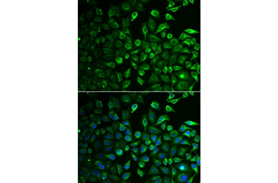 Immunofluorescence - IMPA1 antibody from Signalway Antibody (38864) - Antibodies.com