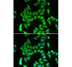 Immunofluorescence - IREB2 antibody from Signalway Antibody (38865) - Antibodies.com