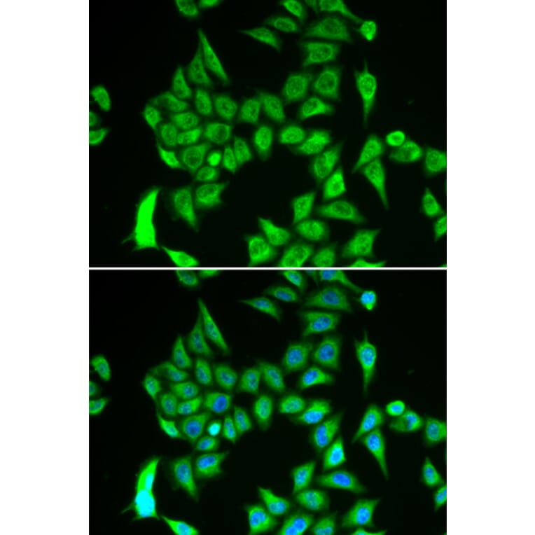 Immunofluorescence - IREB2 antibody from Signalway Antibody (38865) - Antibodies.com