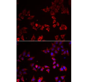 Immunofluorescence - LIMS1 antibody from Signalway Antibody (38867) - Antibodies.com