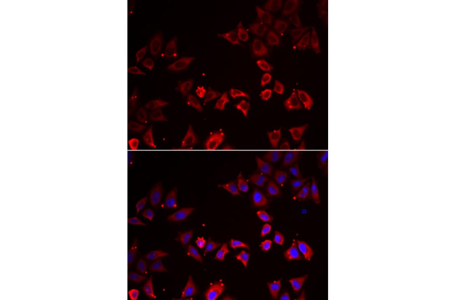 Immunofluorescence - LIMS1 antibody from Signalway Antibody (38867) - Antibodies.com