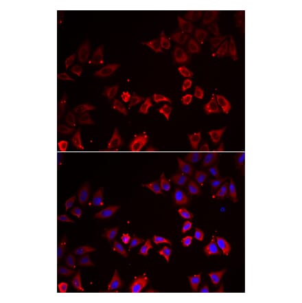 Immunofluorescence - LIMS1 antibody from Signalway Antibody (38867) - Antibodies.com