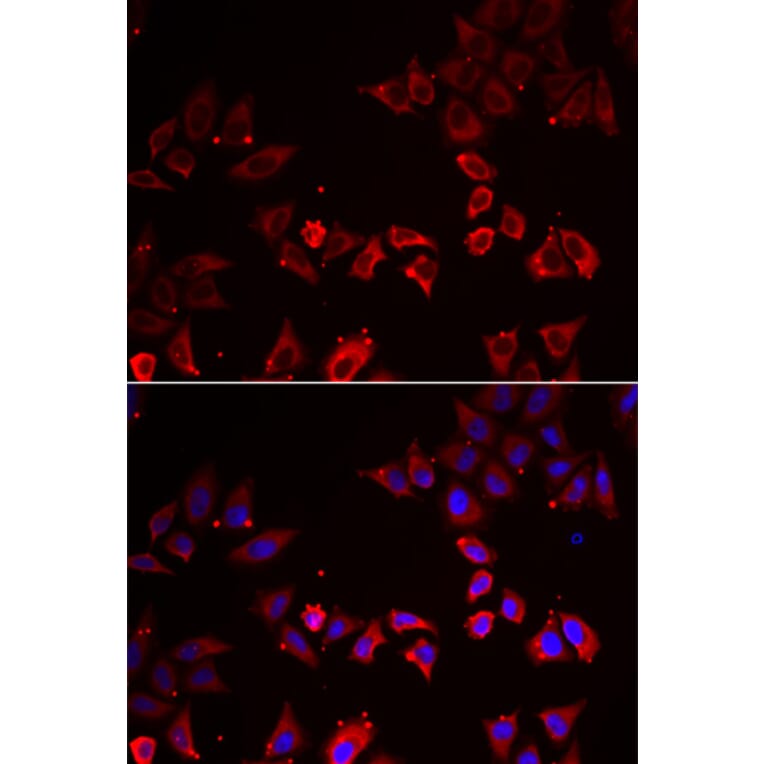 Immunofluorescence - LIMS1 antibody from Signalway Antibody (38867) - Antibodies.com