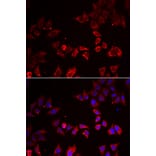 Immunofluorescence - LIMS1 antibody from Signalway Antibody (38867) - Antibodies.com